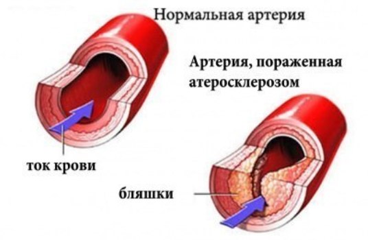 ������ (536x350, 30Kb)