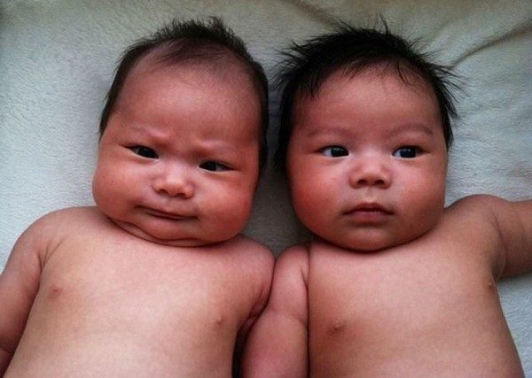 20 трогательных фото близнецов