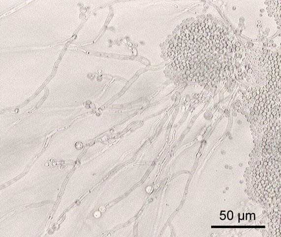 Candida albicans – представитель грибов в кишечнике человека